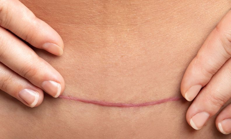 Chăm sóc mẹ sau sinh non như thế nào?